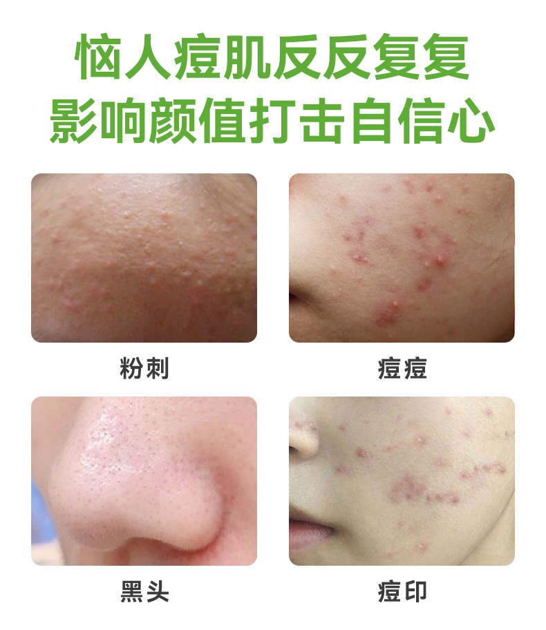 丹参草本祛痘精华液详情_06.jpg